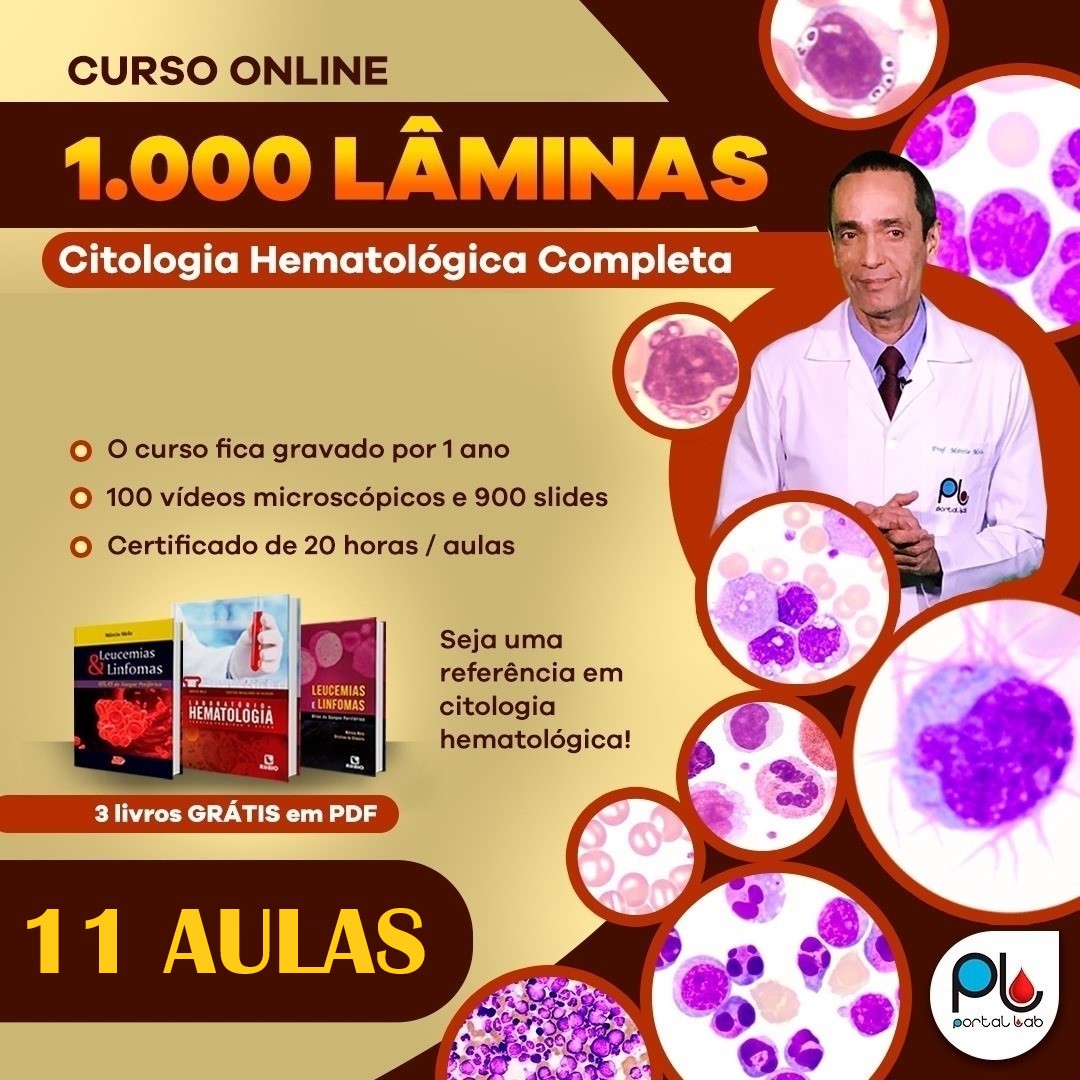 banner Curso - 1.000 Lâminas