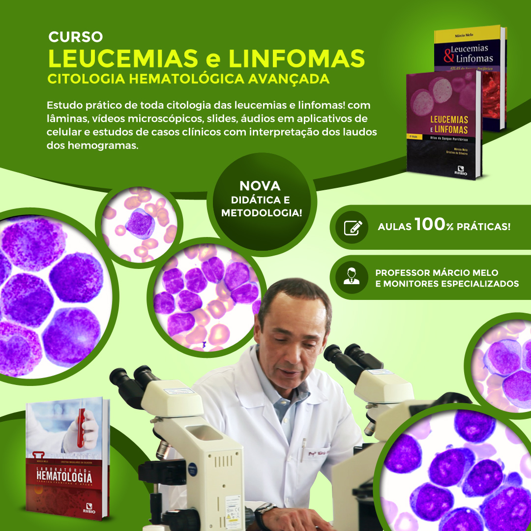 Leucemias e linfomas